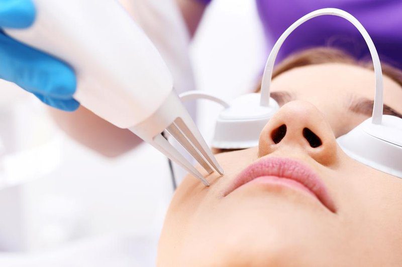 treatment-laser