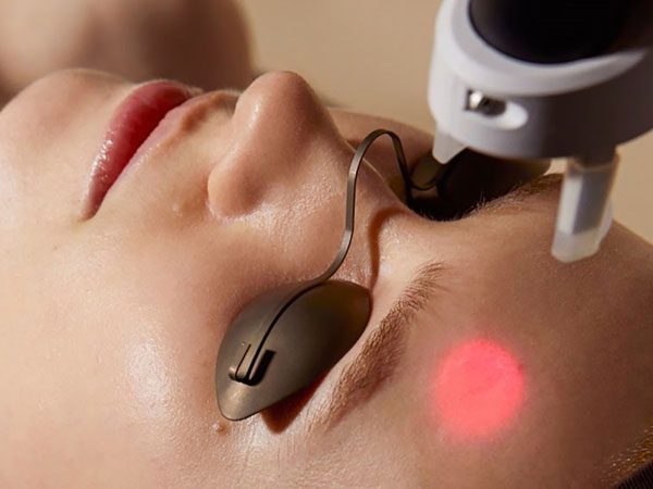 Laser Treatment - DokterNovi_com