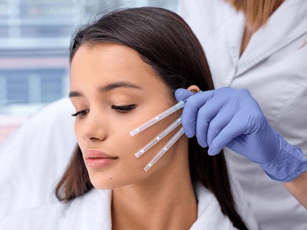 Threadlift Treatment - DokterNovi_com